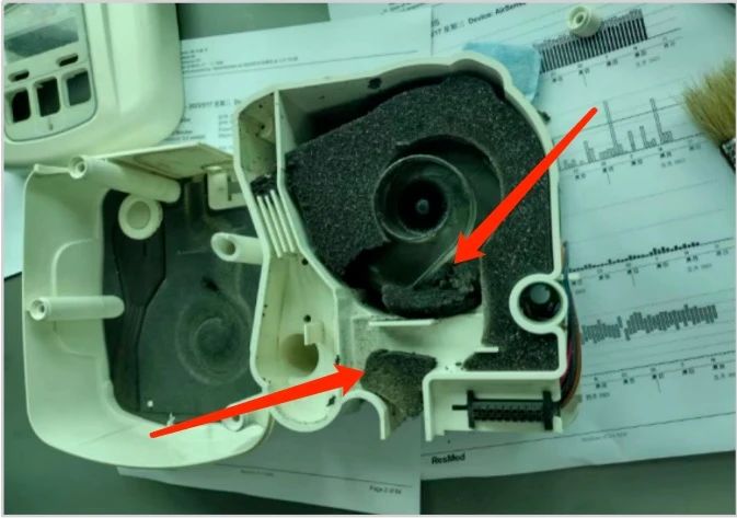 因打鼾使用呼吸机多年，突然发现呼吸机里有黑色颗粒吹出，我该怎么办？