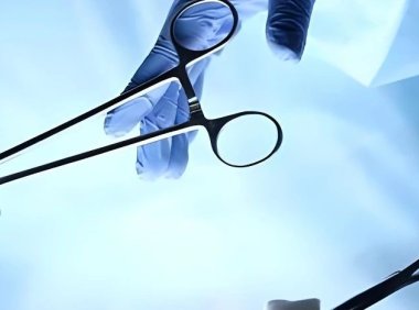 打鼾的手术治疗