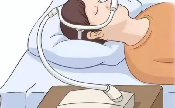 呼吸机治疗:为OSAS患者守护甜美梦乡
